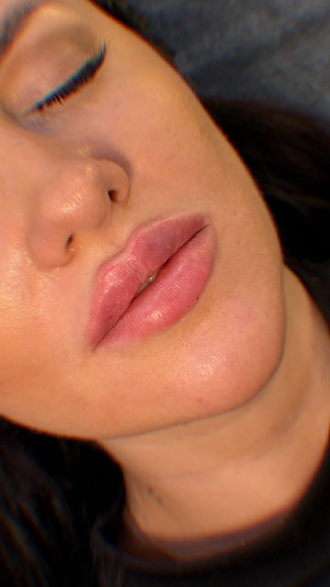 Мягкий контур губ Stylage Special Lips — деликатное увеличение, фото до и после
